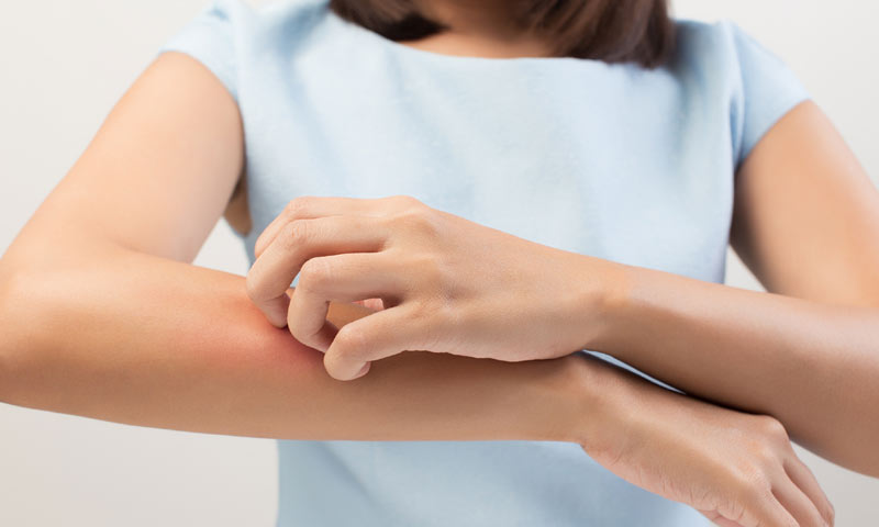 ¿Podemos educar a los mosquitos para que no nos piquen?