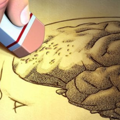 ¿Se puede revertir el Alzheimer?