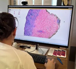 Inteligencia artificial en acción