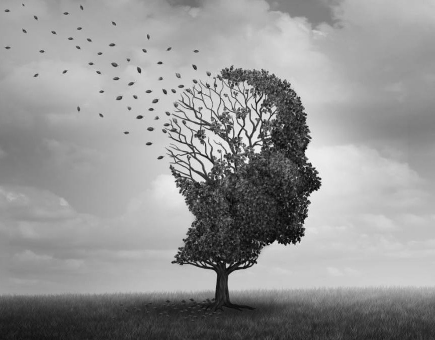 Alzheimer:  litio y antiamiloide, dos vías que se encuentran